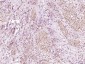 PCYT1A Rabbit pAb